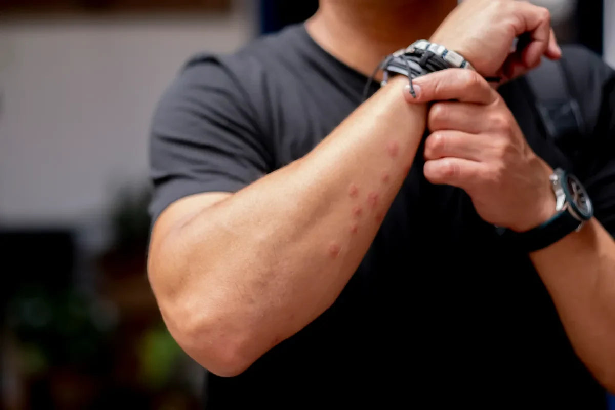 How to Spot the Early Signs of Bed Bugs Before They Spread